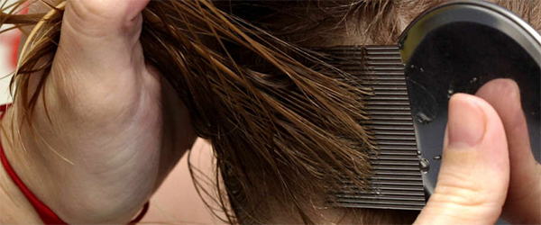 Препараты от педикулеза 2